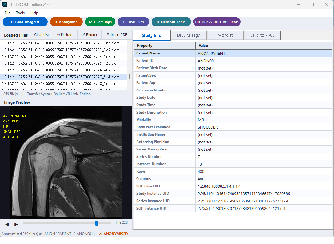 The DICOM Toolbox Interface showing tag inspection and anonymisation controls